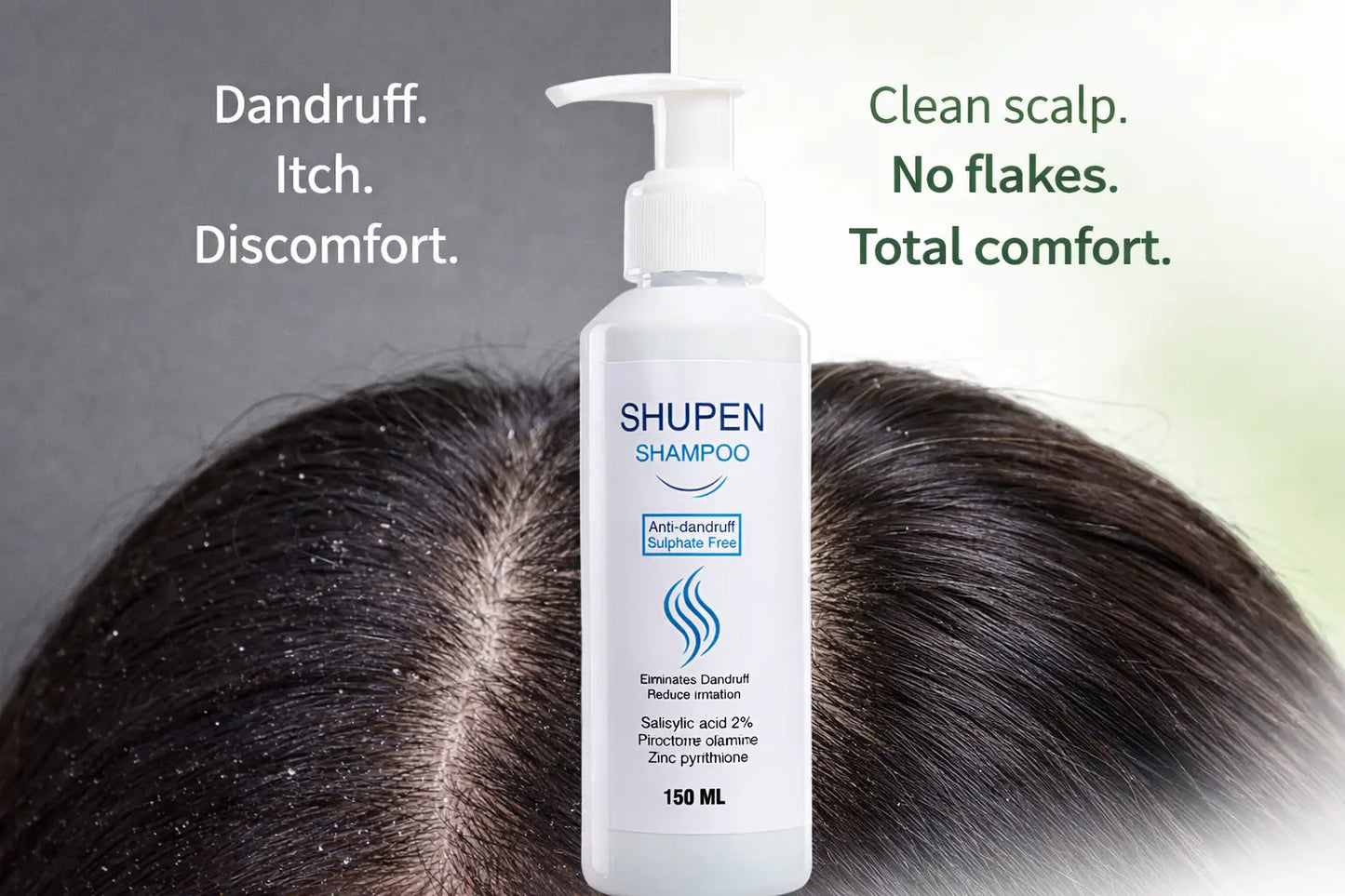 شوبين شامبو القشرة خالى من السالفات 150مل