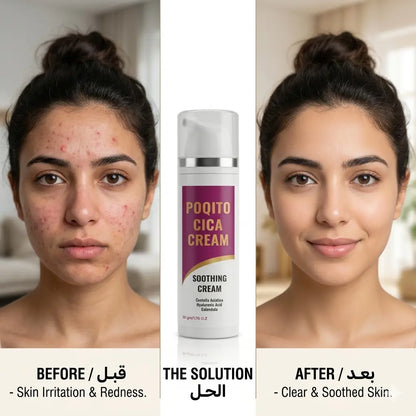 POQITO CICA CREAM 50gm