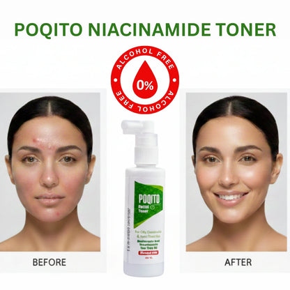 POQITO NIACINAMIDE FACIAL TONER-150ml